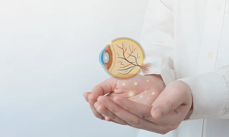 Cataract Surgery