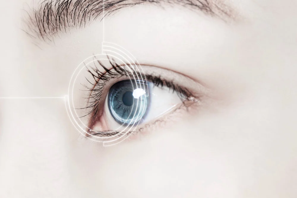 LASIK Eye Surgery