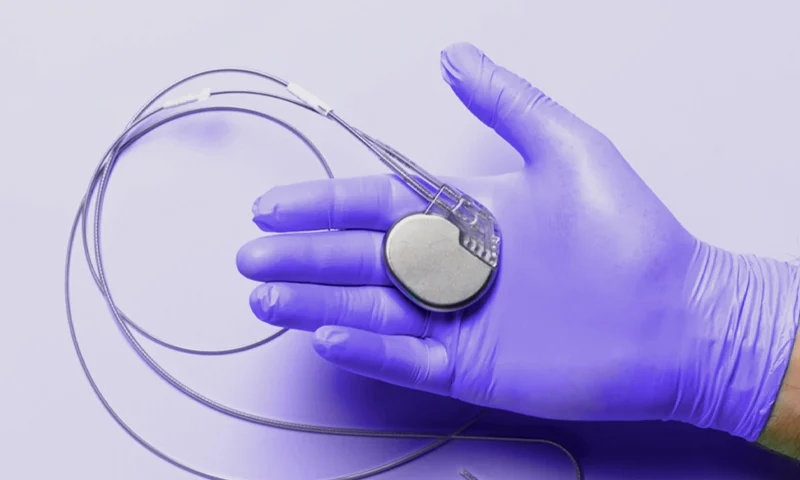 Pacemaker Implantation