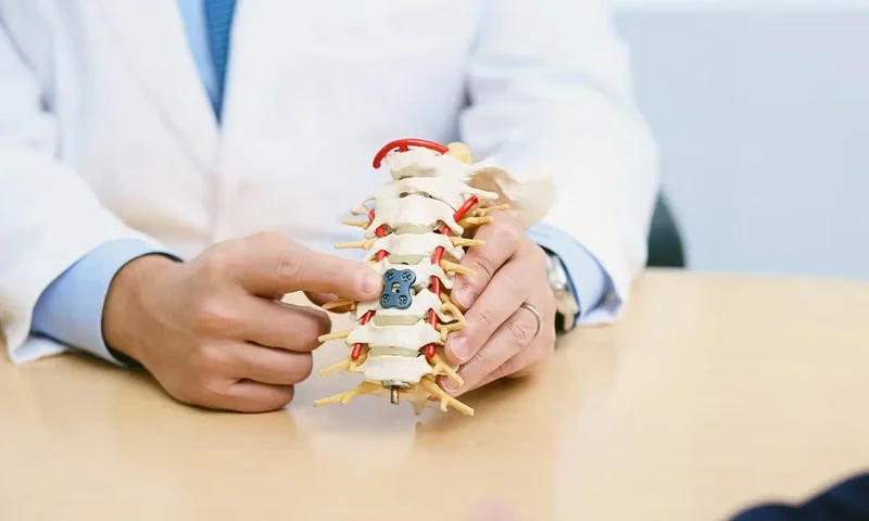 Spinal Fusion Surgery