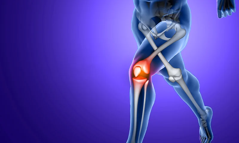 Total Knee Replacement